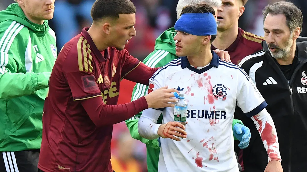 Artikelbild der Quelle zu: Nach Schubser von Kölns El Mala: Zwei Stars von Schalke müssen ausgewechselt werden